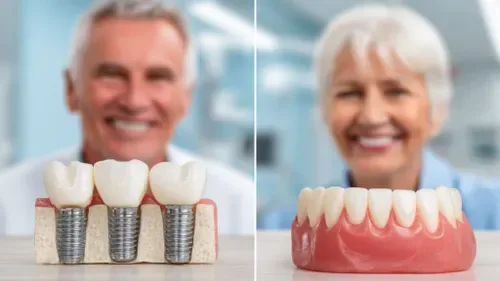 Comparison of dental implants, dentures and bridges as tooth replacement options — Dr. Sri Sushma Dental Clinic Anandbagh Hyderabad