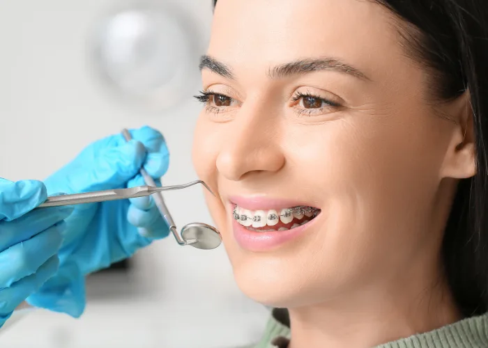 Dental Braces in Hyderabad at Dr. Sri Sushma Multispeciality Dental Clinic, Anandbagh Hyderabad