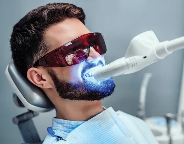 Teeth Whitening at Dr. Sri Sushma Multispeciality Dental Clinic, Anandbagh Hyderabad